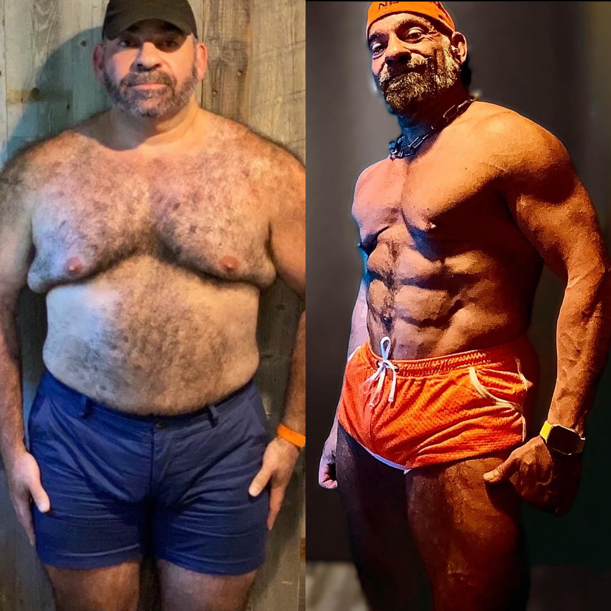 Annotated before photo — hormonal fat-storage sites